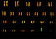 FISH image of human chromosomes