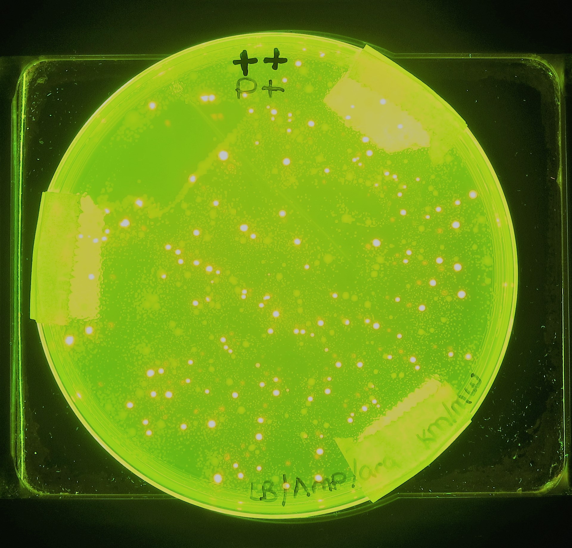 transformed bacterial cells expresing rfp and fluorescing